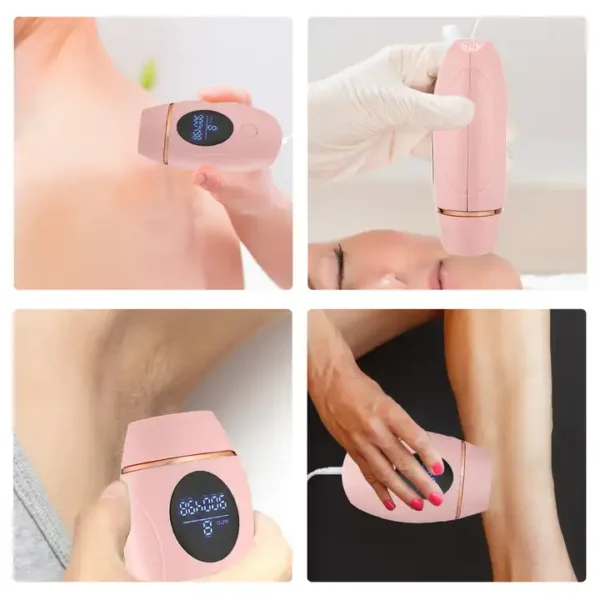 IPL laser Hair Removal