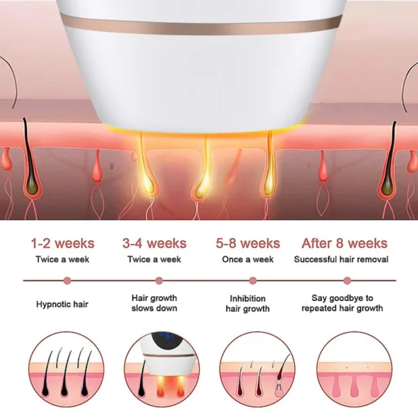 Hair removal